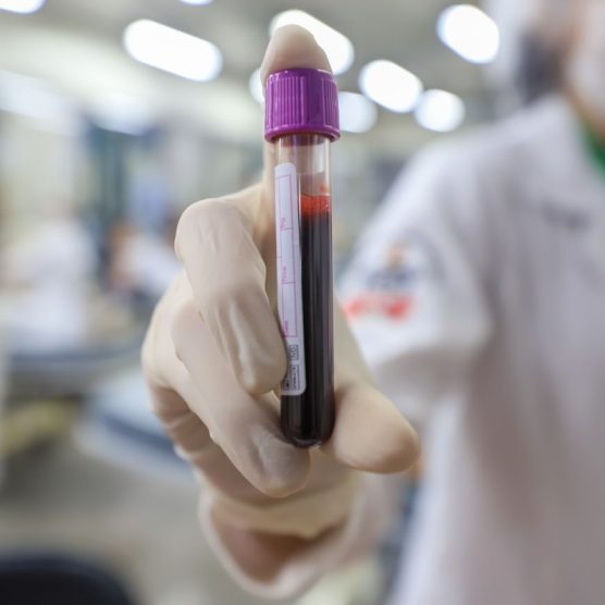 Hemopa e Fapespa realizam campanha de doação de sangue em Belém e pela hemorrede do Pará