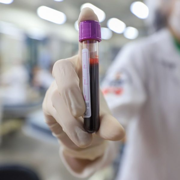 Hemopa e Fapespa realizam campanha de doação de sangue em Belém e pela hemorrede do Pará