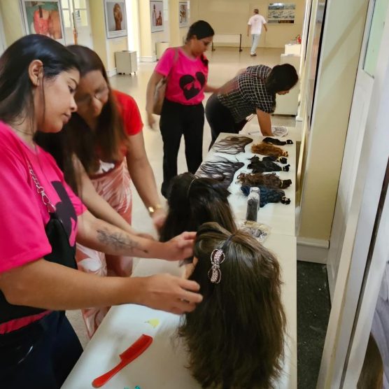 Estudo sobre escalpelamento realizado pela Fapespa aponta perfil das vítimas